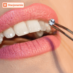 Aplikacja ozdób nazębnych