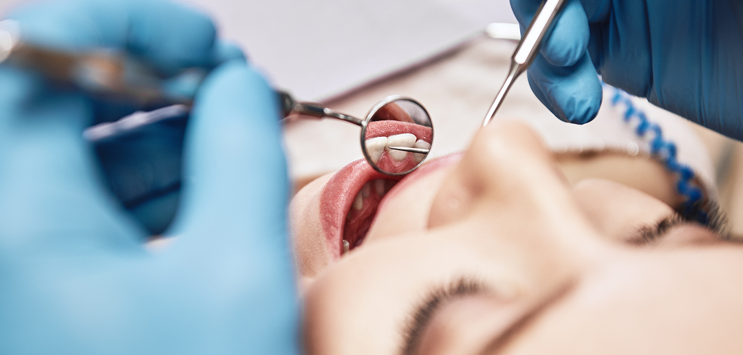 Higienizacja zębów – jakie zabiegi obejmuje i dlaczego są one tak ważne?