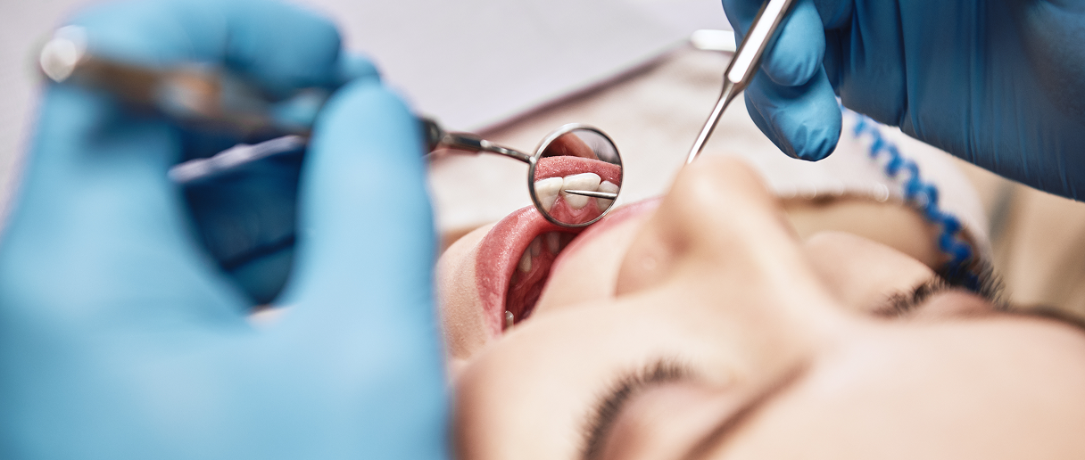 higienizacja zębów