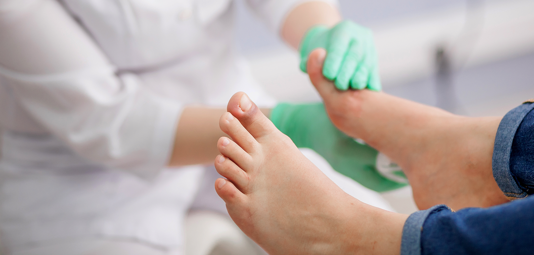 Nadpotliwość stóp – skuteczne metody walki z problemem